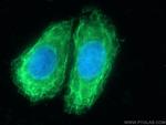 Cytokeratin 15 Antibody in Immunocytochemistry (ICC/IF)