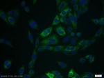 Cytokeratin 15 Antibody in Immunocytochemistry (ICC/IF)