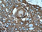 Cytokeratin 15 Antibody in Immunohistochemistry (Paraffin) (IHC (P))