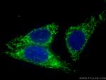 HADHA Antibody in Immunocytochemistry (ICC/IF)