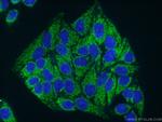 HADHA Antibody in Immunocytochemistry (ICC/IF)