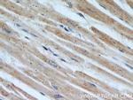 HADHA Antibody in Immunohistochemistry (Paraffin) (IHC (P))