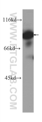 HADHA Antibody in Western Blot (WB)