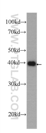 MAPK13 Antibody in Western Blot (WB)