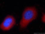 Zyxin Antibody in Immunocytochemistry (ICC/IF)