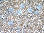 Zyxin Antibody in Immunohistochemistry (Paraffin) (IHC (P))