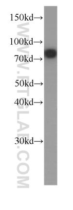 Zyxin Antibody in Western Blot (WB)