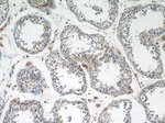 Zyxin Antibody in Immunohistochemistry (Paraffin) (IHC (P))