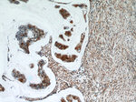 Zyxin Antibody in Immunohistochemistry (Paraffin) (IHC (P))