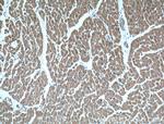 IGBP1 Antibody in Immunohistochemistry (Paraffin) (IHC (P))