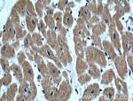 IGBP1 Antibody in Immunohistochemistry (Paraffin) (IHC (P))