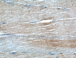 IGBP1 Antibody in Immunohistochemistry (Paraffin) (IHC (P))