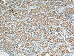 NAPSA Antibody in Immunohistochemistry (Paraffin) (IHC (P))