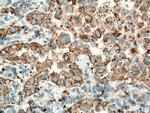 NAPSA Antibody in Immunohistochemistry (Paraffin) (IHC (P))