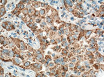 NAPSA Antibody in Immunohistochemistry (Paraffin) (IHC (P))