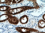 NAPSA Antibody in Immunohistochemistry (Paraffin) (IHC (P))