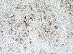 NAPSA Antibody in Immunohistochemistry (Paraffin) (IHC (P))