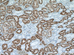 NAPSA Antibody in Immunohistochemistry (Paraffin) (IHC (P))