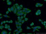 IL1R2 Antibody in Immunocytochemistry (ICC/IF)