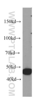 IL1R2 Antibody in Western Blot (WB)