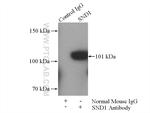 SND1 Antibody in Immunoprecipitation (IP)