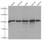 SND1 Antibody in Western Blot (WB)