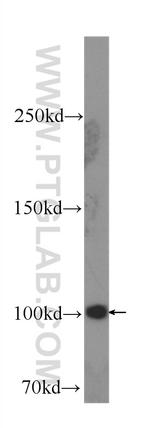 SND1 Antibody in Western Blot (WB)