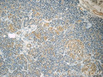 SND1 Antibody in Immunohistochemistry (Paraffin) (IHC (P))