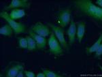 BAX Antibody in Immunocytochemistry (ICC/IF)