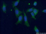 BAX Antibody in Immunocytochemistry (ICC/IF)