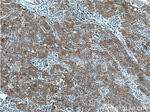 BAX Antibody in Immunohistochemistry (Paraffin) (IHC (P))