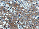 BAX Antibody in Immunohistochemistry (Paraffin) (IHC (P))