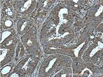 PKM2 Antibody in Immunohistochemistry (Paraffin) (IHC (P))