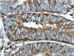 PKM2 Antibody in Immunohistochemistry (Paraffin) (IHC (P))