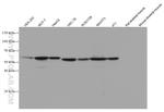 PKM2 Antibody in Western Blot (WB)