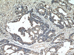 PKM2 Antibody in Immunohistochemistry (Paraffin) (IHC (P))