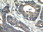 PKM2 Antibody in Immunohistochemistry (Paraffin) (IHC (P))