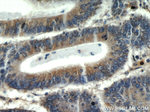 PKM2 Antibody in Immunohistochemistry (Paraffin) (IHC (P))