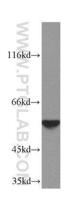 PKM2 Antibody in Western Blot (WB)