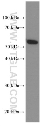 PKM2 Antibody in Western Blot (WB)