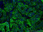 Thyroglobulin Antibody in Immunohistochemistry (PFA fixed) (IHC (PFA))