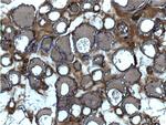 Thyroglobulin Antibody in Immunohistochemistry (Paraffin) (IHC (P))