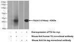 Thyroglobulin Antibody in Western Blot (WB)