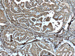 Thyroglobulin Antibody in Immunohistochemistry (Paraffin) (IHC (P))