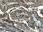 Thyroglobulin Antibody in Immunohistochemistry (Paraffin) (IHC (P))