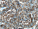 Thyroglobulin Antibody in Immunohistochemistry (Paraffin) (IHC (P))