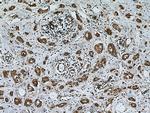 Chk1 Antibody in Immunohistochemistry (Paraffin) (IHC (P))