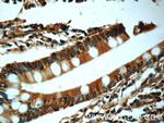 Chk1 Antibody in Immunohistochemistry (Paraffin) (IHC (P))