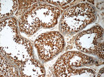 Chk1 Antibody in Immunohistochemistry (Paraffin) (IHC (P))