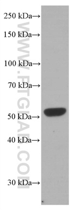 Chk1 Antibody in Western Blot (WB)